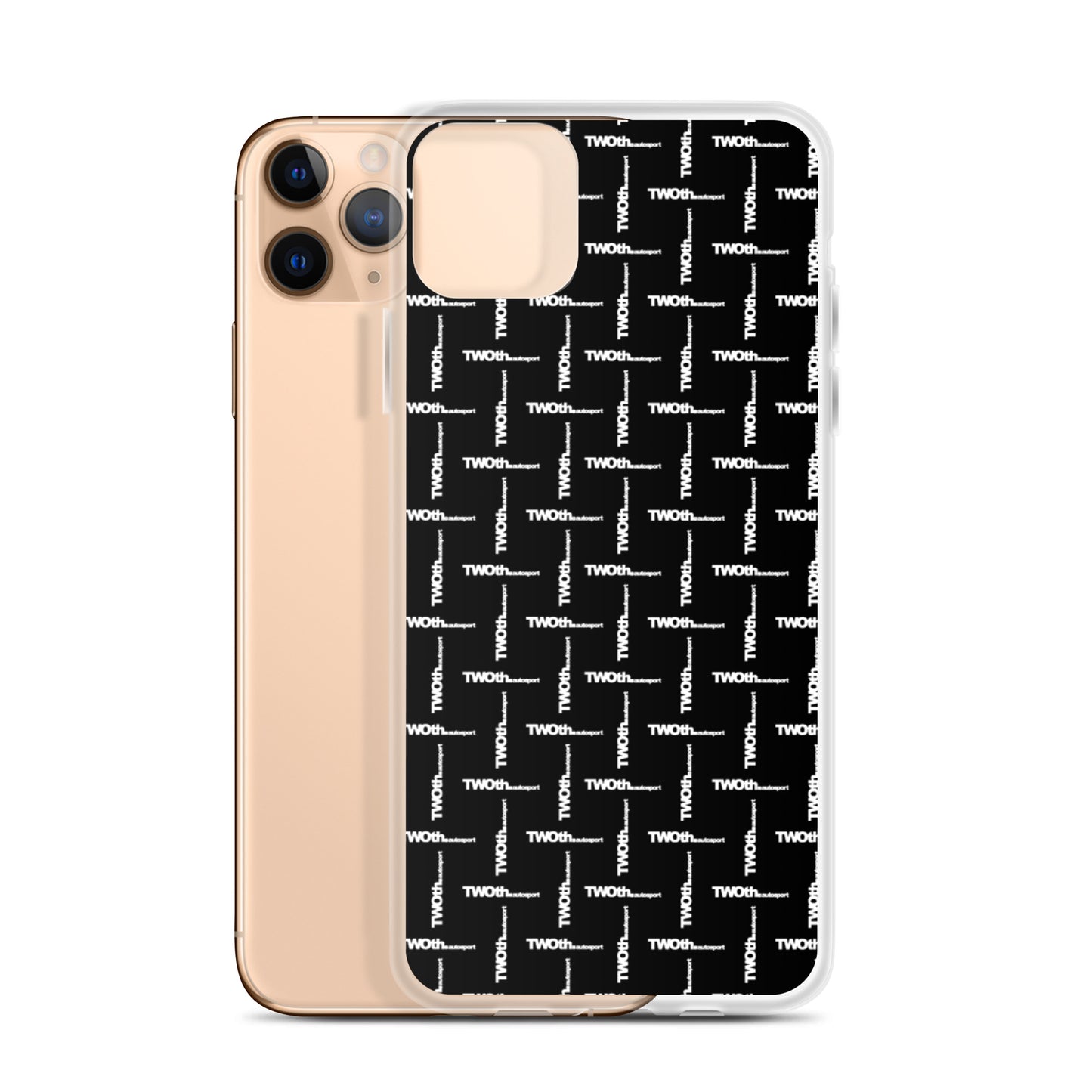 DesignerCarbon | iPhone Case